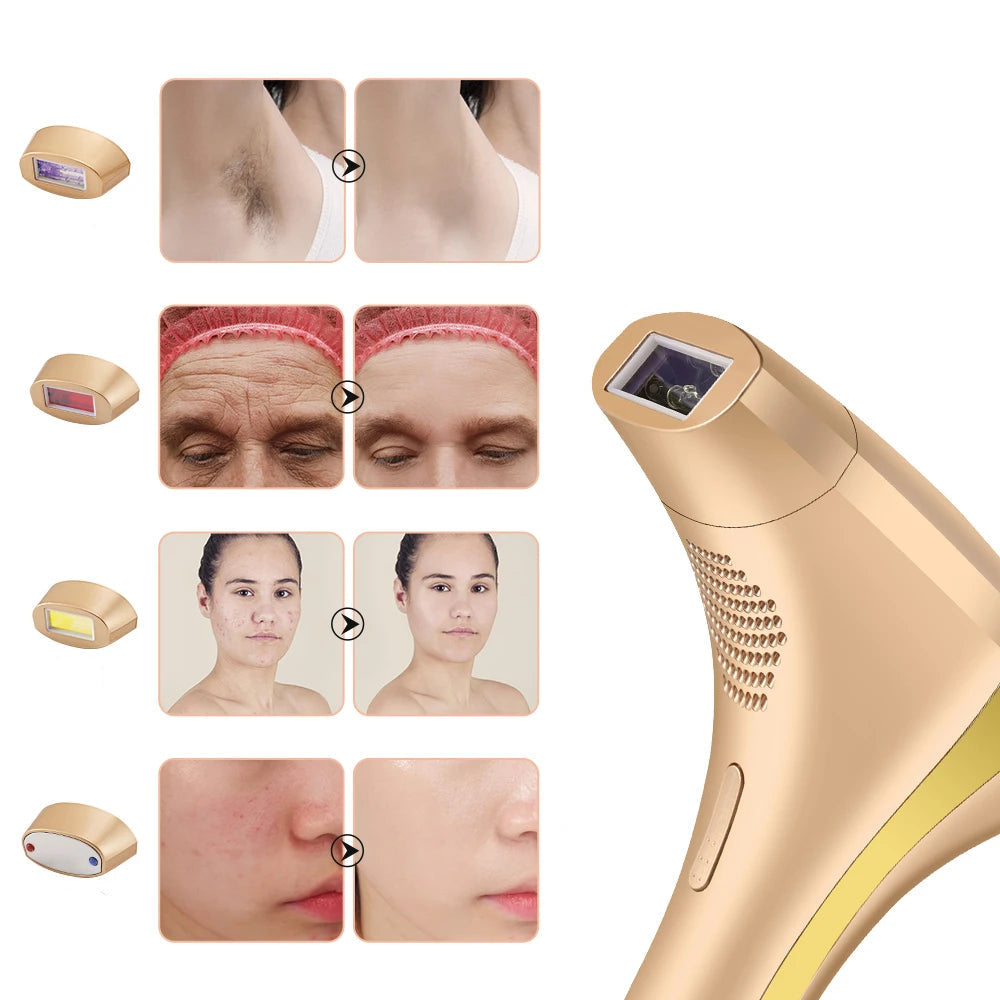 Hårfjerning Enhet for Ansikt og Kropp med IPL Teknologi Bærbar 1