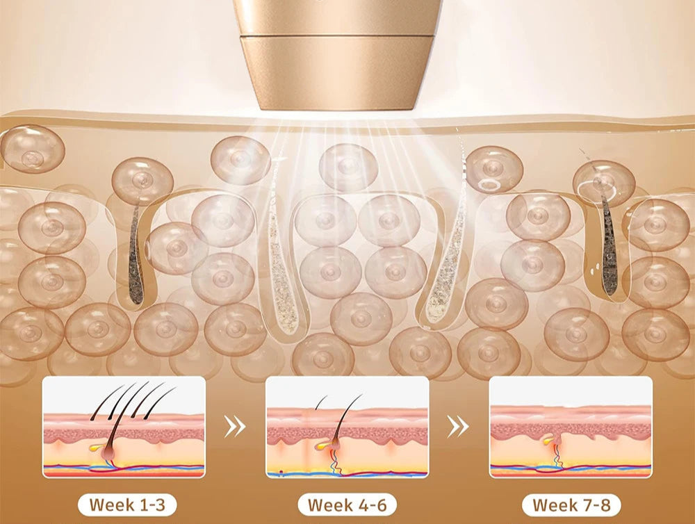 Hårfjerning Enhet for Ansikt og Kropp med IPL Teknologi Bærbar 5
