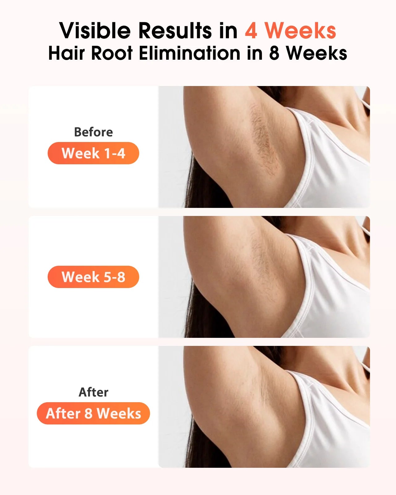 Hårfjerning Enhet for Menn og Kvinner med 9 Nivåer 2